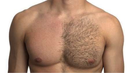Photo ads/2002000/2002068/a2002068.png : Épilation masculin