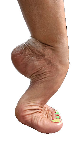 Photo ads/2508000/2508412/a2508412.jpg : Rech. pied tres cambré de femme pour seance photo